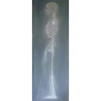 X-Ray Side